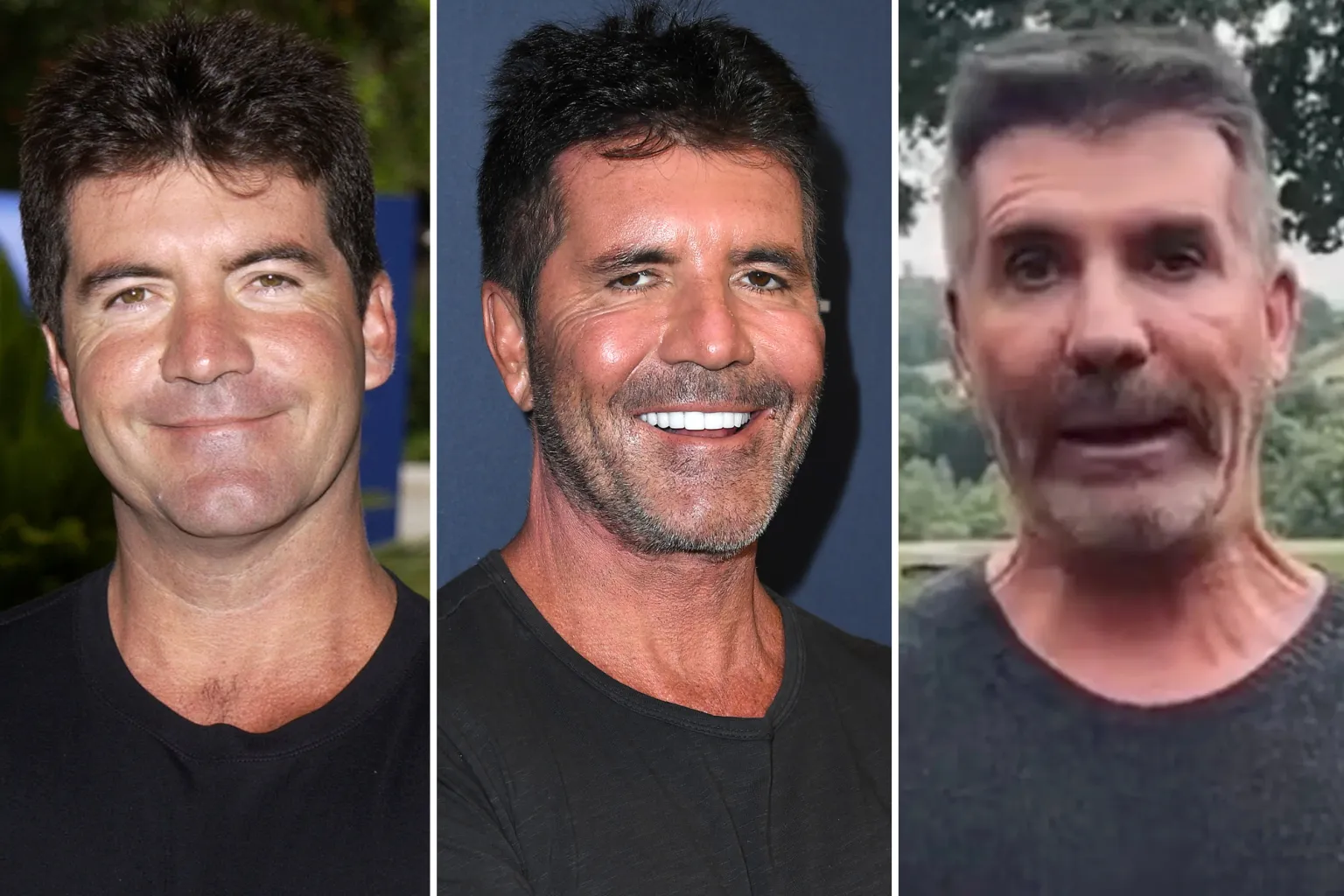 Simon Cowell’s face, then and now See pictures of his transforming